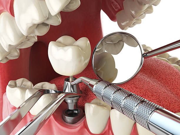 Best Same-Day Emergency Dental Services in Tripoli, IA